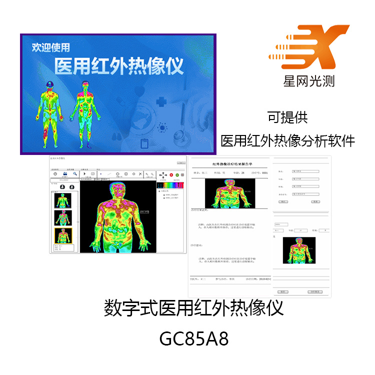 星网光测医用红外热像仪GC85A8