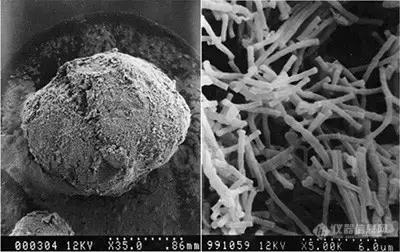 电镜下的颗粒污泥和产甲烷丝菌.jpg