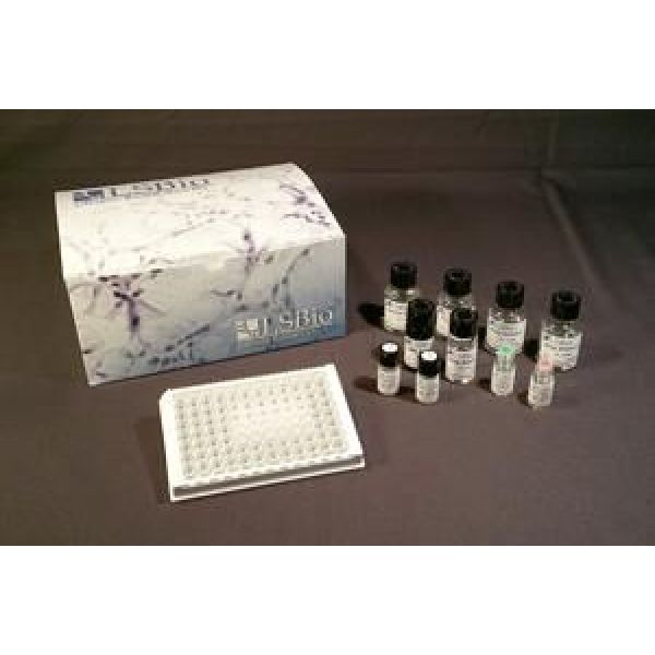 NPHN试剂盒；小鼠肾足蛋白(NPHN)ELISA试剂盒