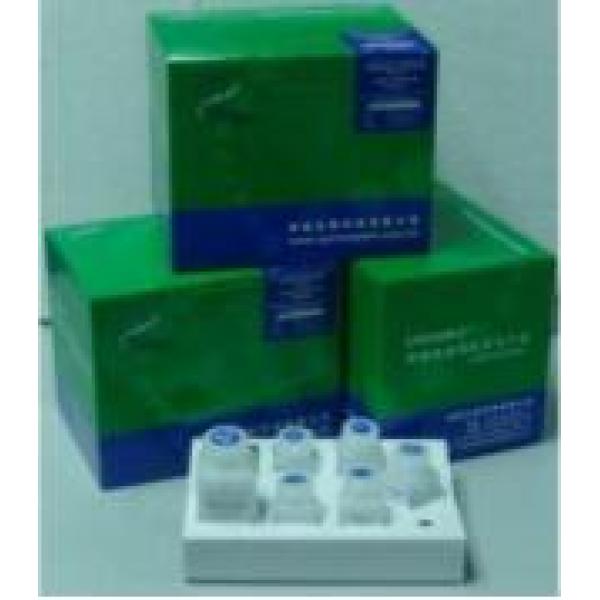 SSB试剂盒；小鼠干燥综合征抗原B(SSB)ELISA试剂盒
