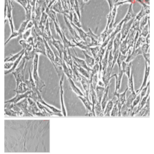 人角膜成纤维细胞