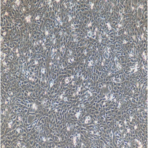 MB49；小鼠膀胱癌细胞