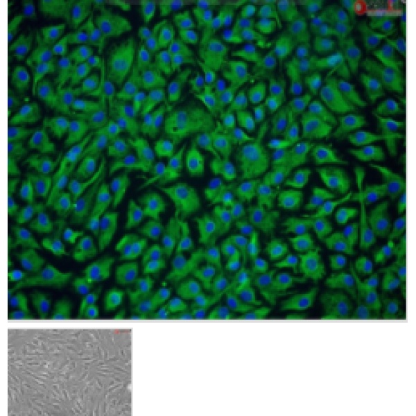 人子宫肌瘤组织源细胞