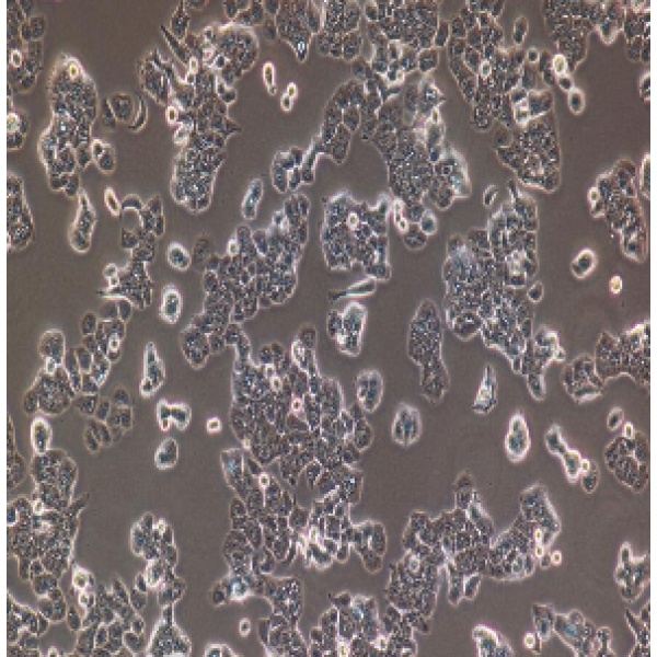 MDA-MB-435人乳腺癌高转移细胞【已通过STR鉴定】