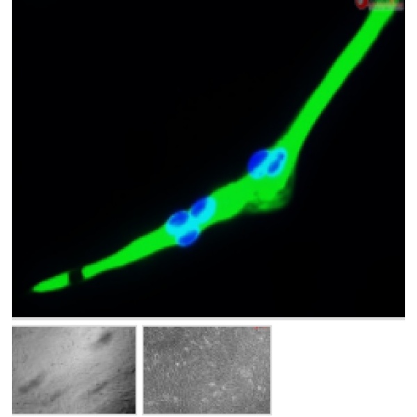 大鼠肾小球系膜细胞