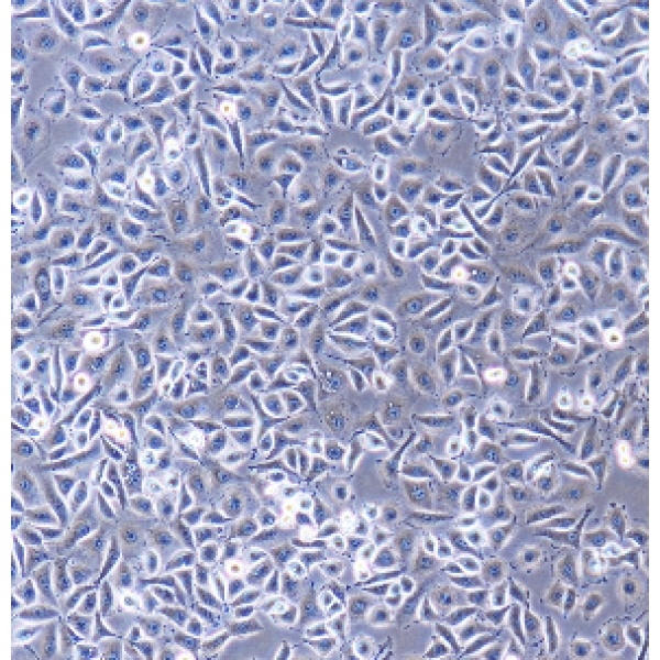 HUVEC(HUV-EC-C) 人脐静脉血管内皮细胞