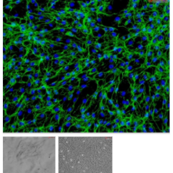 人神经星形胶质细胞