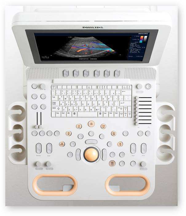 飞利浦CX50 女性健康护理超声系统