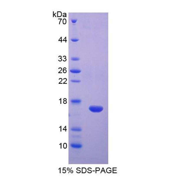 DAB1蛋白；Disabled同源物1(DAB1)重组蛋白