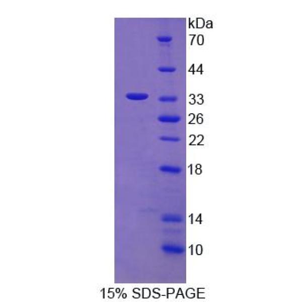 CEP110蛋白；110kDa中心体蛋白(CEP110)重组蛋白
