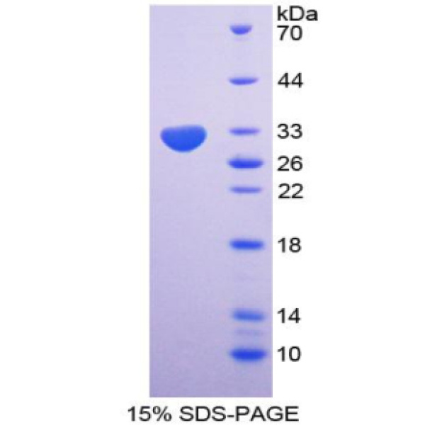 NUP85蛋白；85kDa核孔蛋白(NUP85)重组蛋白