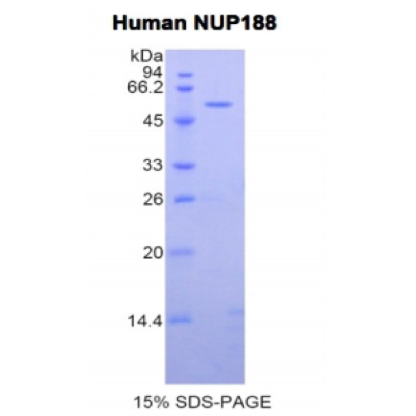 NUP188蛋白；188kDa核孔蛋白(NUP188)重组蛋白