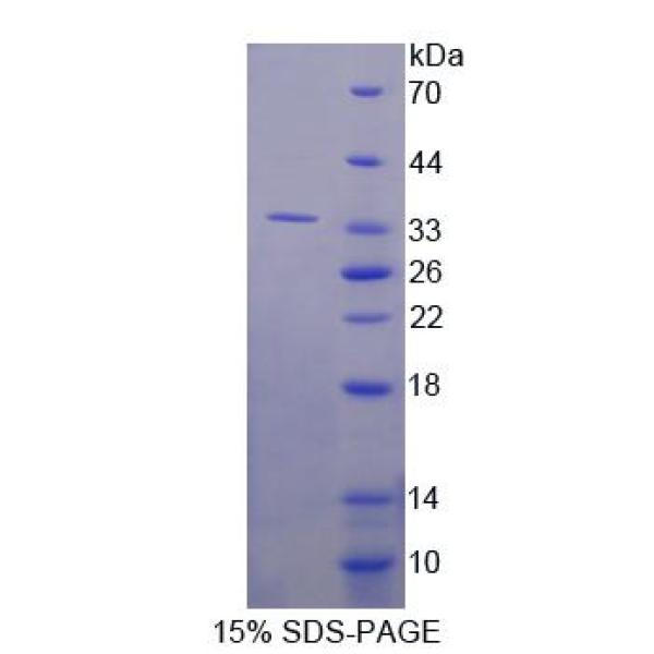 RSU1蛋白；Ras抑制蛋白1(RSU1)重组蛋白