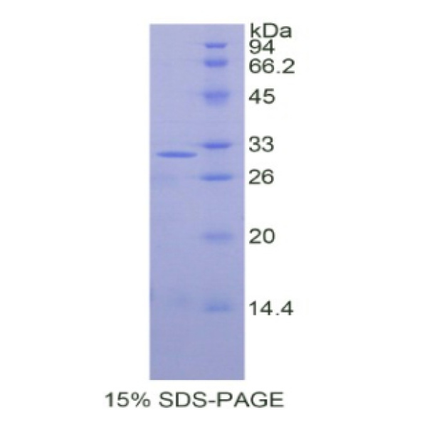 SEPT5蛋白；胞裂蛋白5(SEPT5)重组蛋白