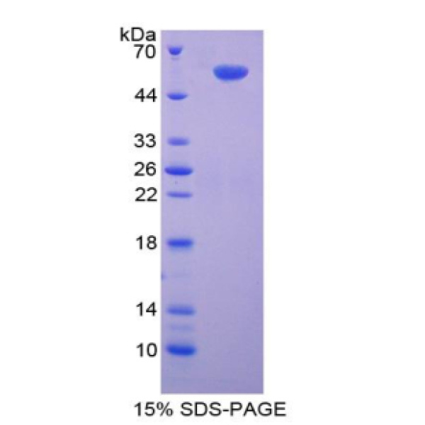 Smad9蛋白；Smad同源物9(Smad9)重组蛋白