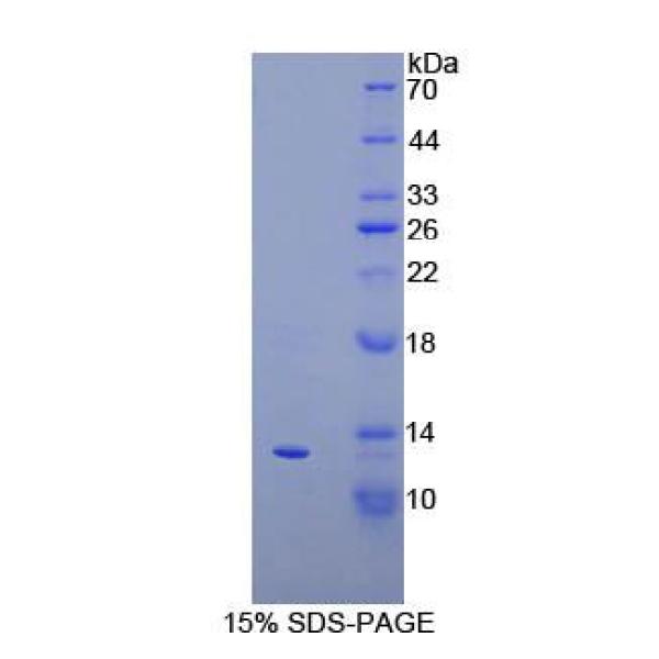 IP10蛋白；10kDa干扰素γ诱导蛋白(IP10)重组蛋白