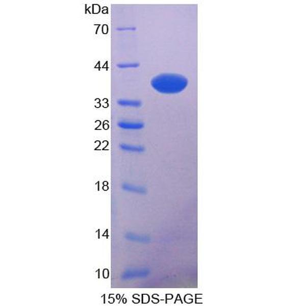 PICP蛋白；N-myc下游调节基因2(NDRG2)重组蛋白