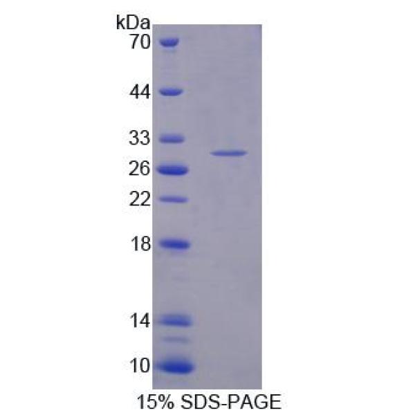 PSMa5蛋白；蛋白酶体亚基α5(PSMa5)重组蛋白