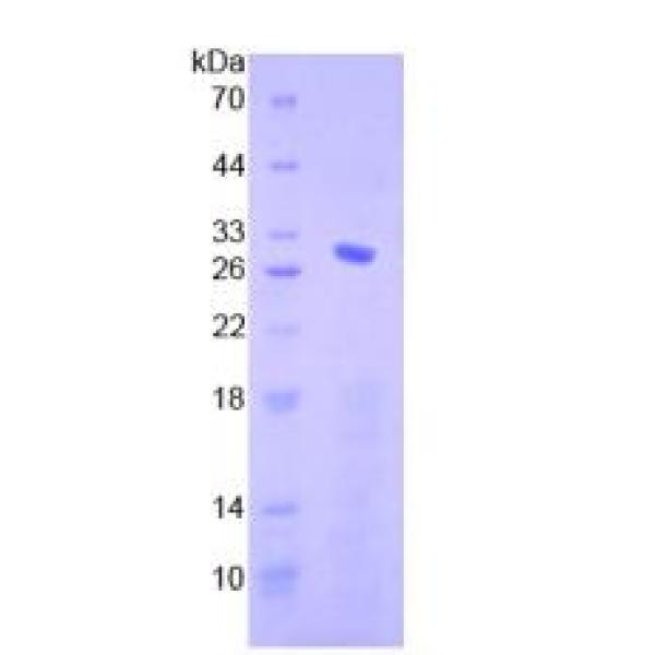 Smad4蛋白；Smad同源物4(Smad4)重组蛋白