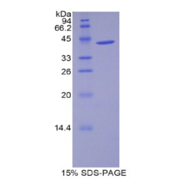 WFDC5蛋白；WAP四二硫化物核心域蛋白5(WFDC5)重组蛋白