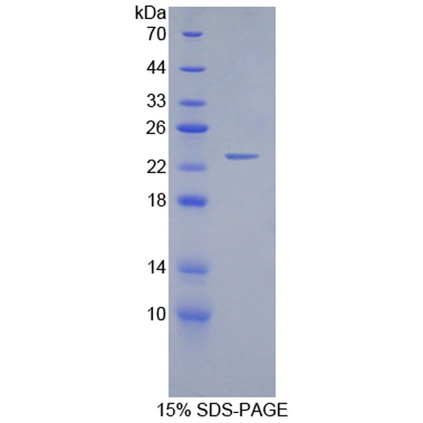 GREM1蛋白；Gremlin 1蛋白(GREM1)重组蛋白