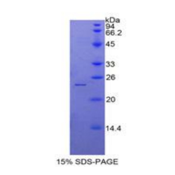 SPTAN1蛋白；α-胞衬蛋白(SPTAN1)重组蛋白