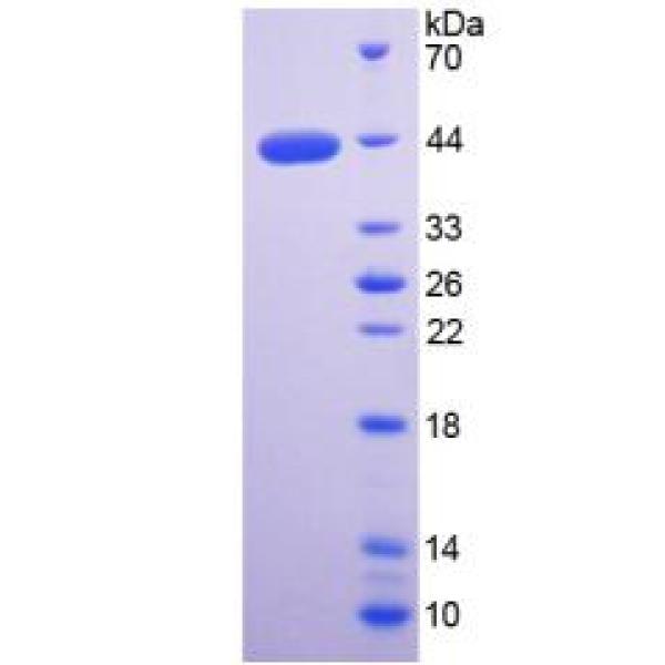 WFDC2蛋白；WAP四二硫化物核心域蛋白2(WFDC2)重组蛋白