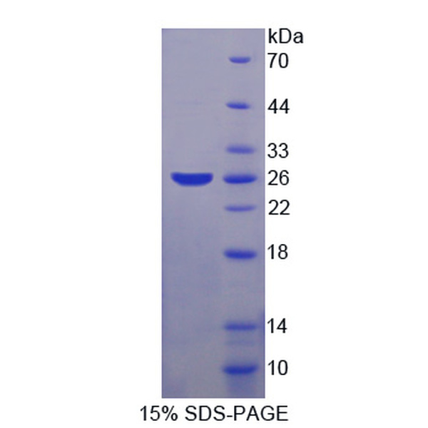 SKP1蛋白；S-期激酶关联蛋白1(SKP1)重组蛋白