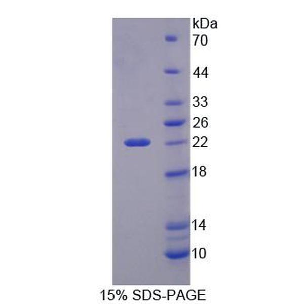 PHF8蛋白；PHD指蛋白8(PHF8)重组蛋白