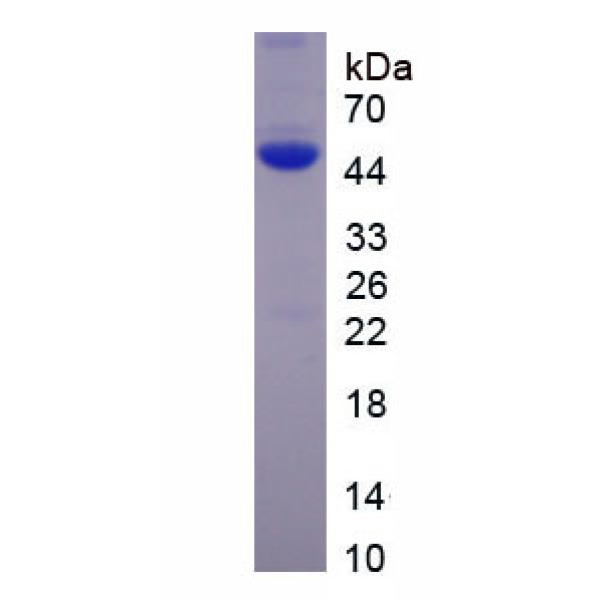 L-型电压依赖性钙离子通道α1D亚基(CACNa1D)重组蛋白