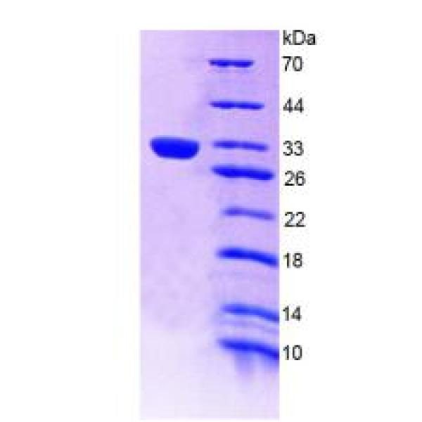 LDLR蛋白；低密度脂蛋白受体(LDLR)重组蛋白