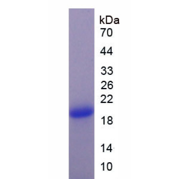 DBI蛋白；安定结合抑制因子(DBI)重组蛋白