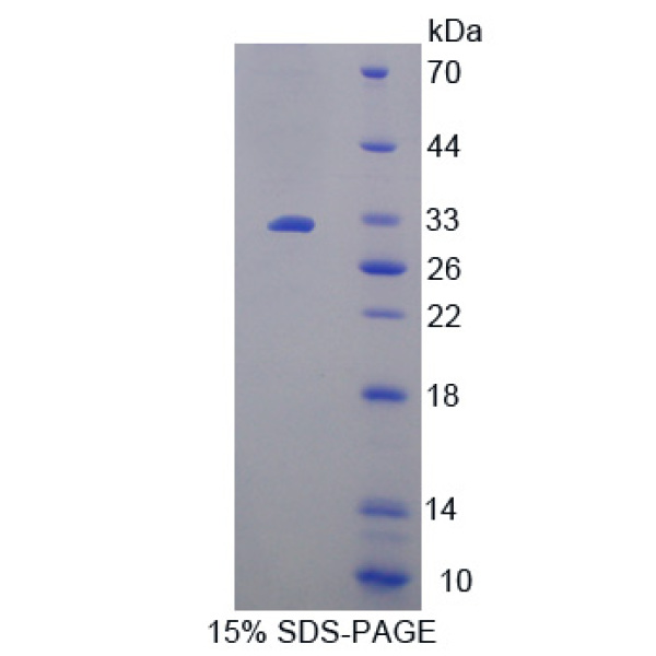 PRKAa2激活蛋白激酶α2(PRKAa2)重组蛋白