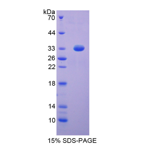 DFFa蛋白；DNA片段化因子亚基α(DFFa)重组蛋白