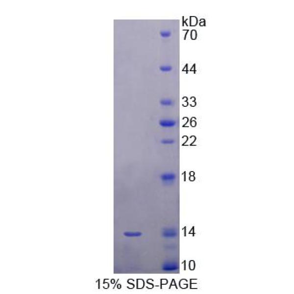 SRP9蛋白；9kDa信号识别颗粒(SRP9)重组蛋白
