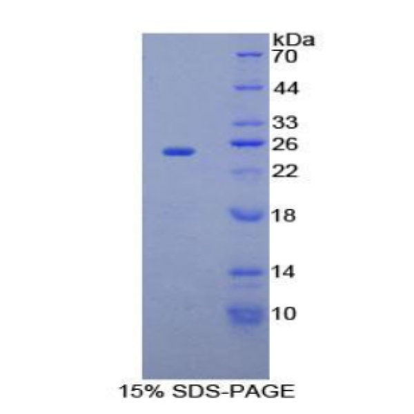 SPRY2蛋白；侧支发芽因子同源物2(SPRY2)重组蛋白