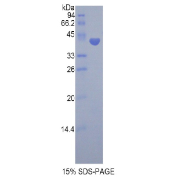 FSHb蛋白；促卵泡素β(FSHb)重组蛋白