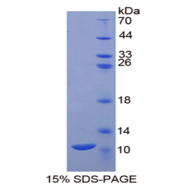 PKIb蛋白；蛋白激酶抑制因子β(PKIb)重组蛋白