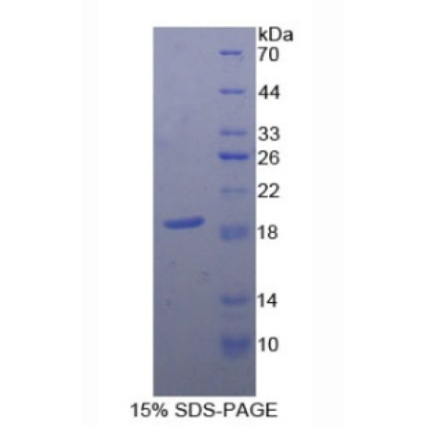 CD59蛋白；保护素(CD59)重组蛋白