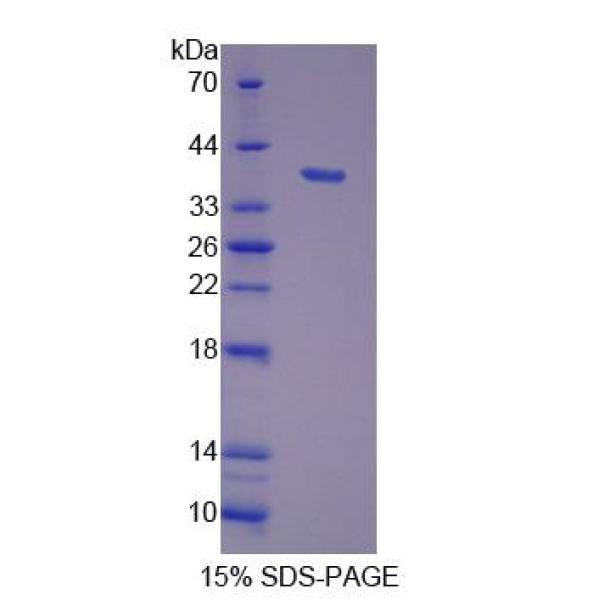 DOCK4蛋白；胞质分裂作用因子4(DOCK4)重组蛋白