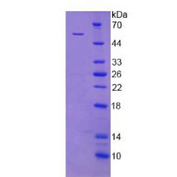 XRCC5蛋白；X-射线修复交叉互补蛋白5(XRCC5)重组蛋白