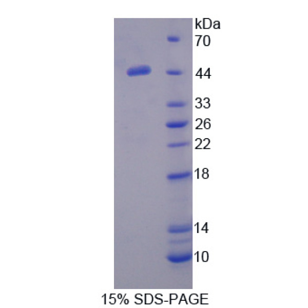 PCI蛋白；蛋白C抑制因子(PCI)重组蛋白