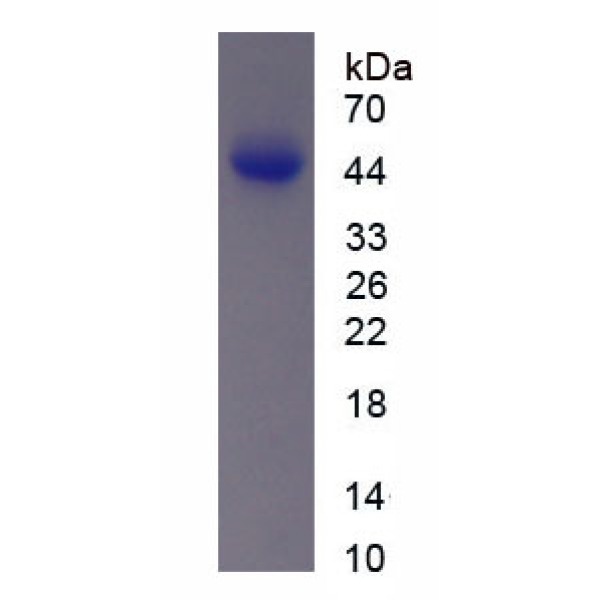 CCK4蛋白；胆囊收缩素4(CCK4)重组蛋白