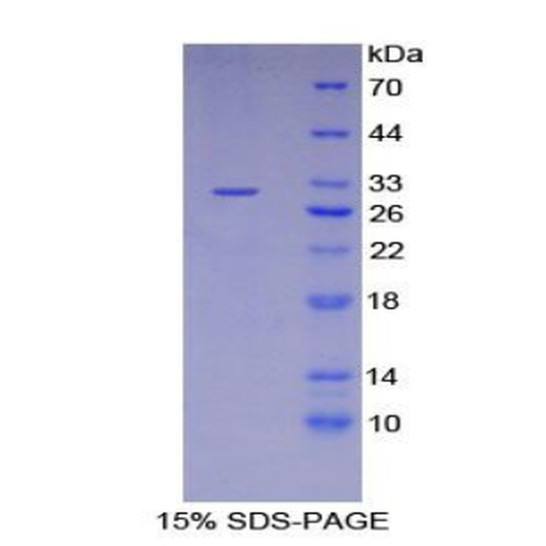 LIMS1蛋白；LIM衰老细胞抗原样域蛋白1(LIMS1)重组蛋白