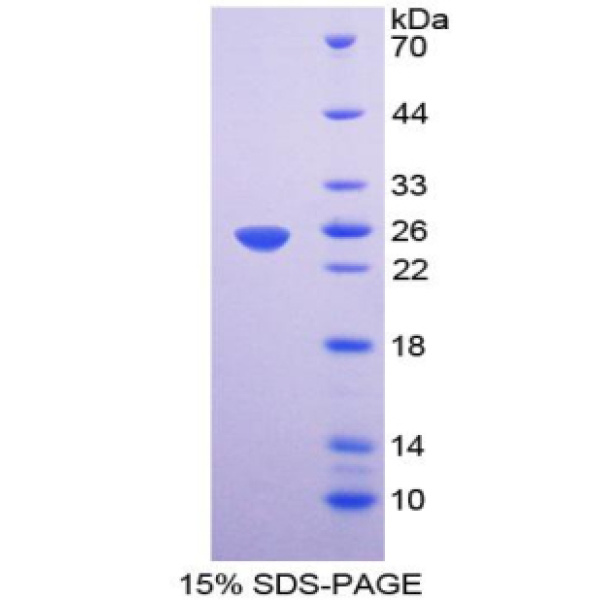 EMILIN1蛋白；弹性蛋白微原纤维界面因子1(EMILIN1)重组蛋白