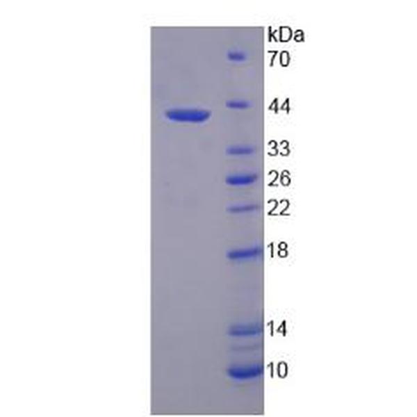 SKP2蛋白；S-期激酶关联蛋白2(SKP2)重组蛋白