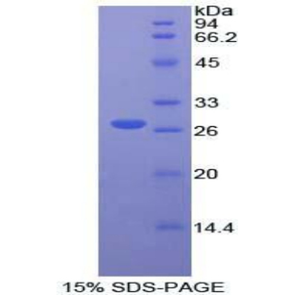 FRS2蛋白；成纤维生长因子受体底物2(FRS2)重组蛋白
