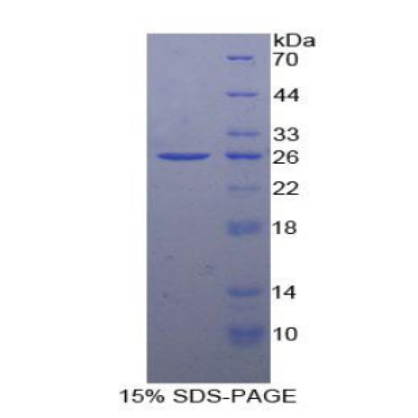 Bid蛋白；BH3相互作用域死亡激动剂(Bid)重组蛋白