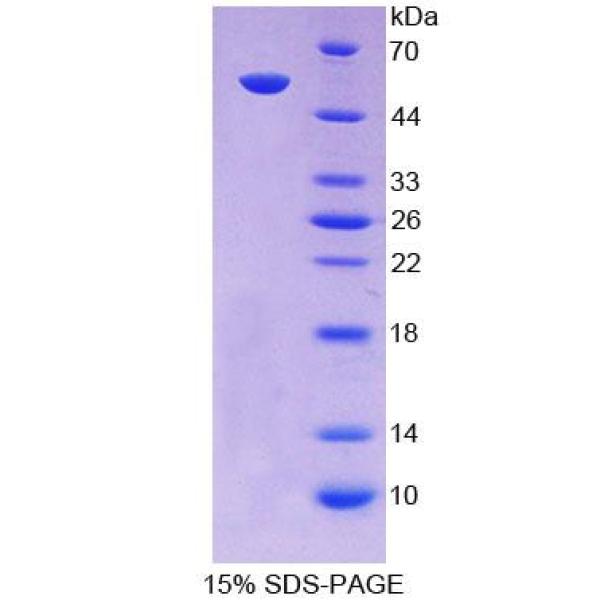 SCNN1a蛋白；阿米洛利敏感钠离子通道蛋白1α(SCNN1a)重组蛋白