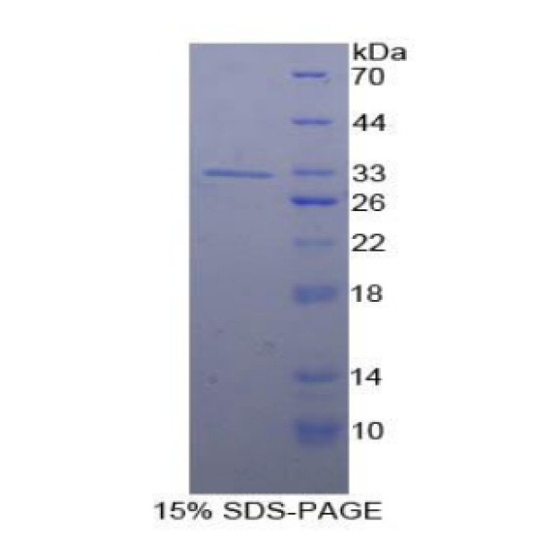Smad5蛋白；Smad同源物5(Smad5)重组蛋白